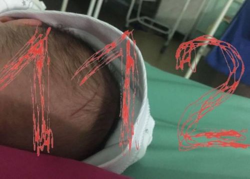 Яңа ел бәйрәмнәрендә балалар тудыру йортында 9 бала вафат булган