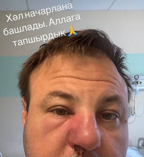 Җырчы Илнар Сәйфиев хастаханәгә эләккән