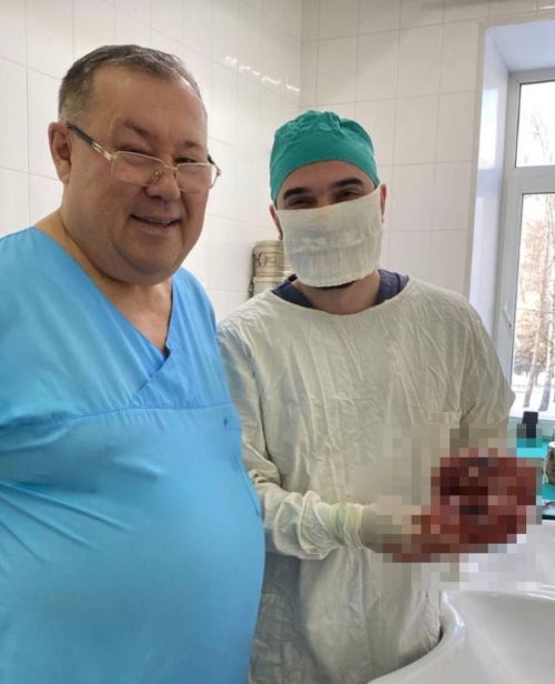 Зеленодольск үзәк район хастаханәсе табиблары, эшләүдән туктаган бөерен алып, пациентның гомерен саклап калды