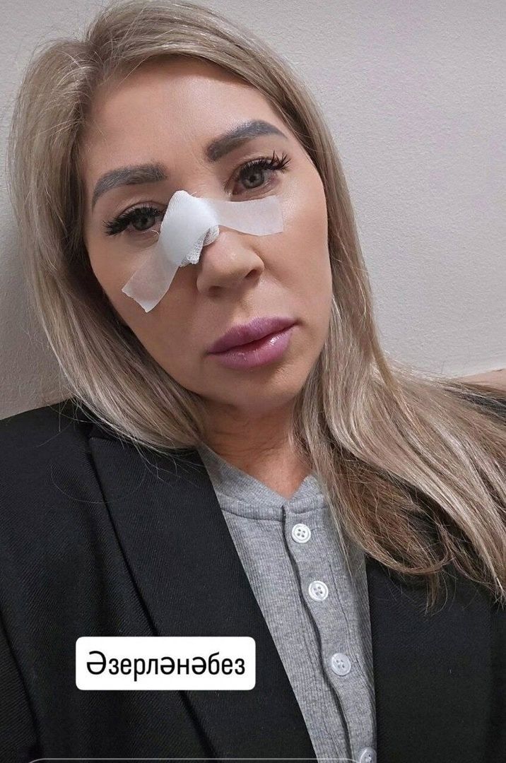Танылган татар алып баручысы яман шеш белән көрәшә